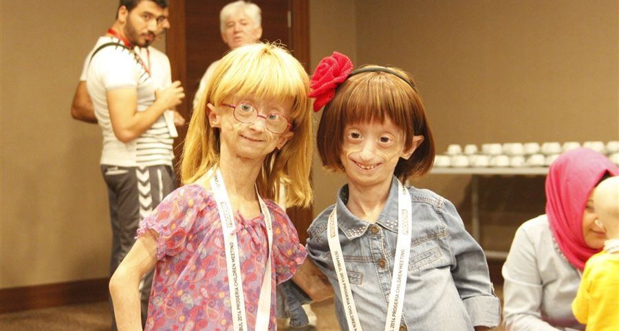 İstanbul 2014 Uluslararası Progeria Çocuklar Buluşması